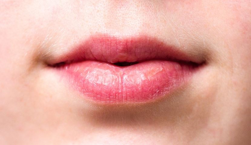 a crop photo of a person’s dry lips