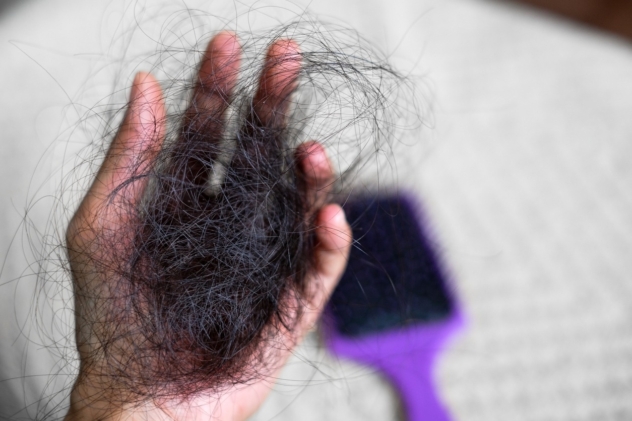 Hair loss, Hair loss problem
