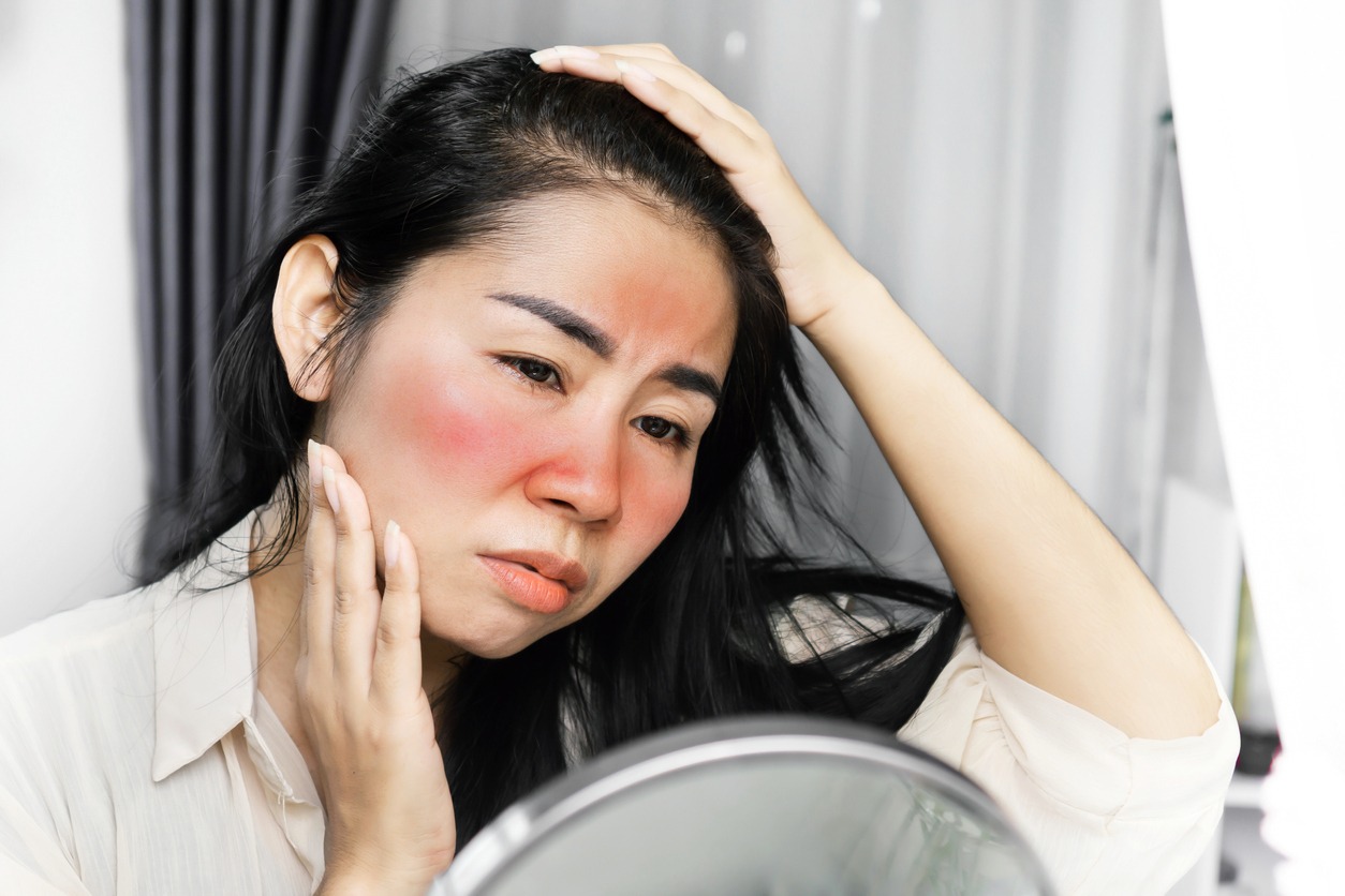 Sad Asian woman having problem with sunburn on the face, checking her redness skin on a mirror because of ultraviolet from sunlight