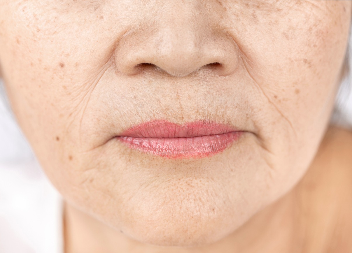 wrinkle freckles and skin line on close up elderly asian woman face 60-70 years old, healthy skin care concept