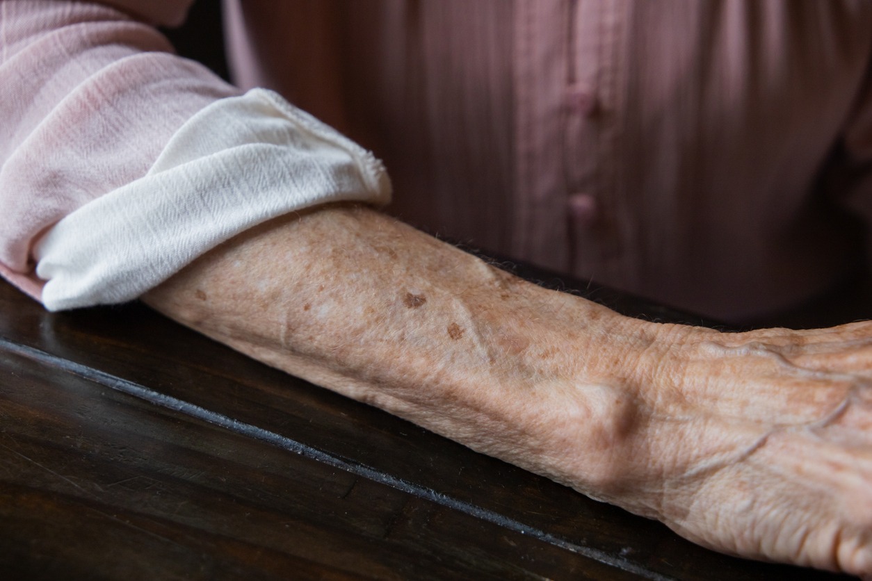 An elderly woman grandmother's arm with wrinkles and age spots and her sleeve rolled up.