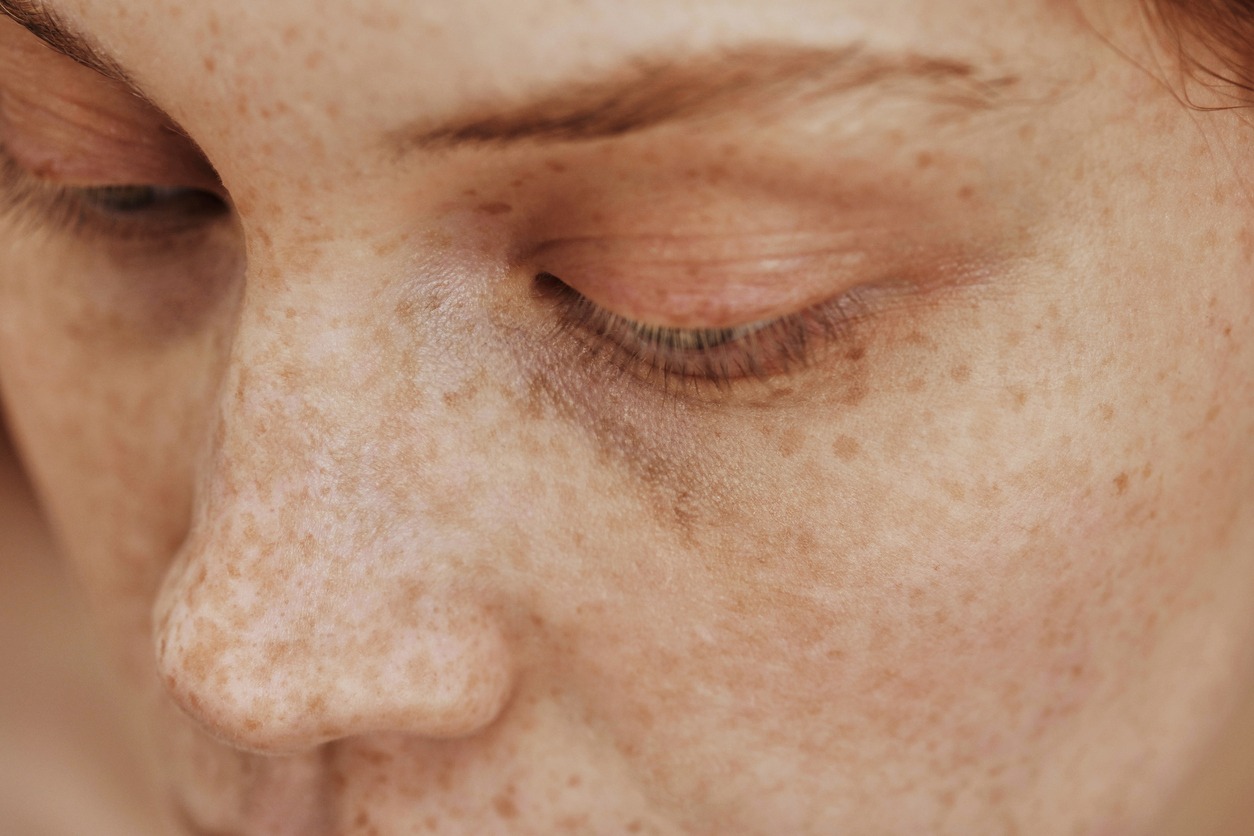 Macro shot of face with freckles of young natural woman with no-makeup on her eyes