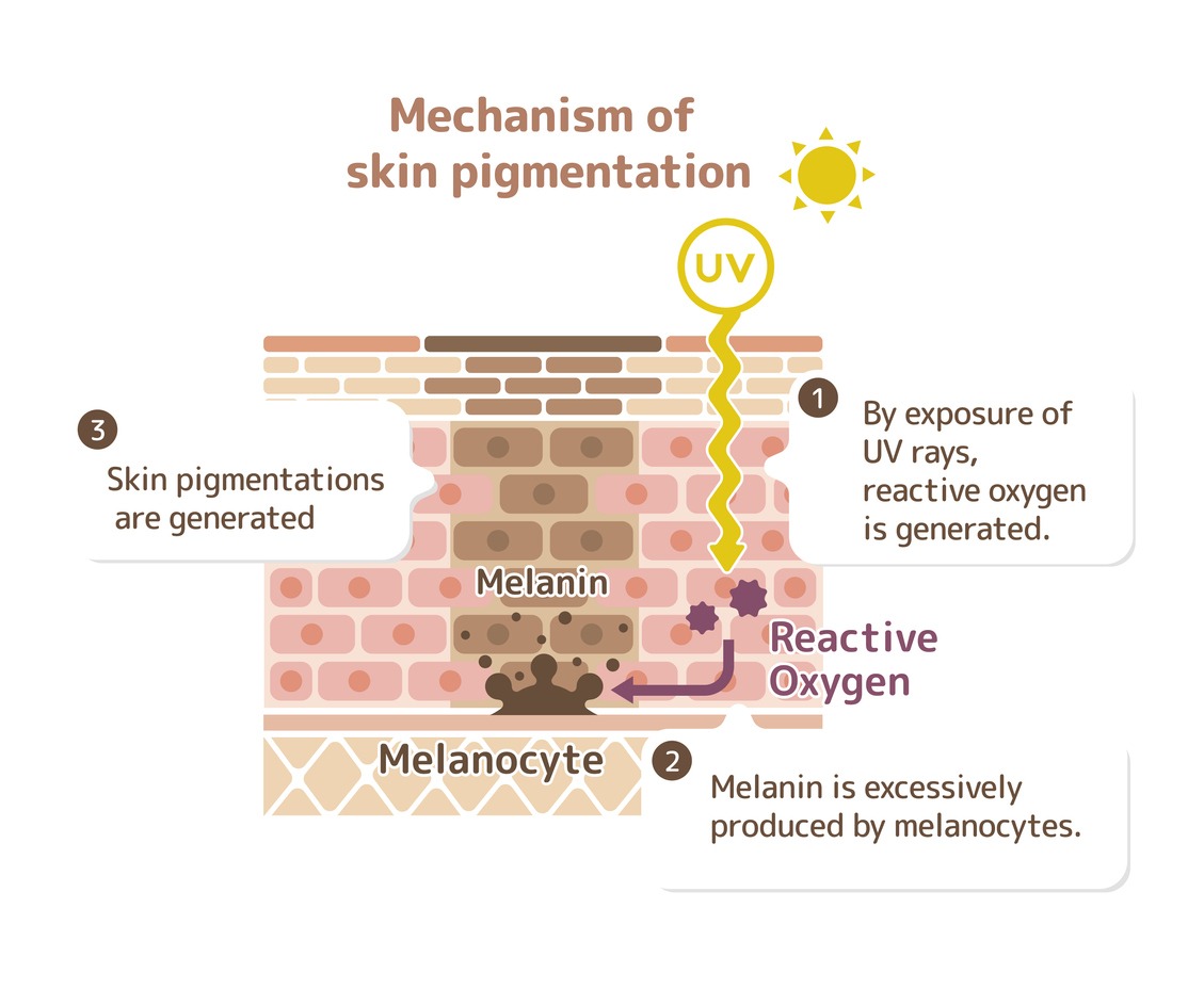 mechanism of skin pigmentation / skin spot illustration (with explanation)