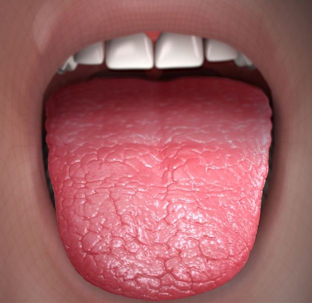 3D-Medical-animation-still-showing-Dry-Mouth-condition.