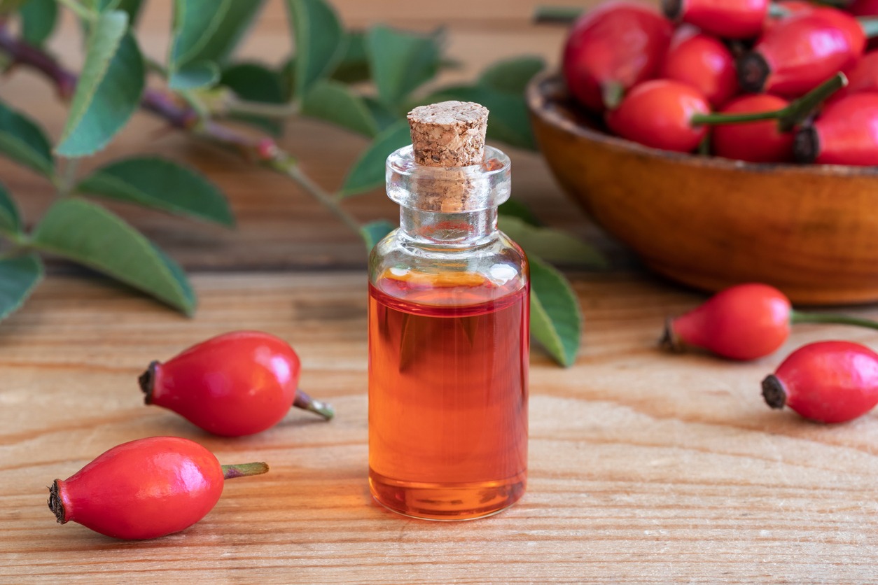 a-bottle-of-rose-hip-seed-oil-with-fresh-rose-hips-on-a-table